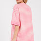 STRIPED OVERSIZED BABY PINK TOP