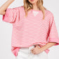 STRIPED OVERSIZED BABY PINK TOP