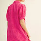 SCALLOP HEM PINK DRESS